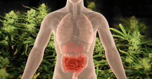 ganja a Crohnova choroba