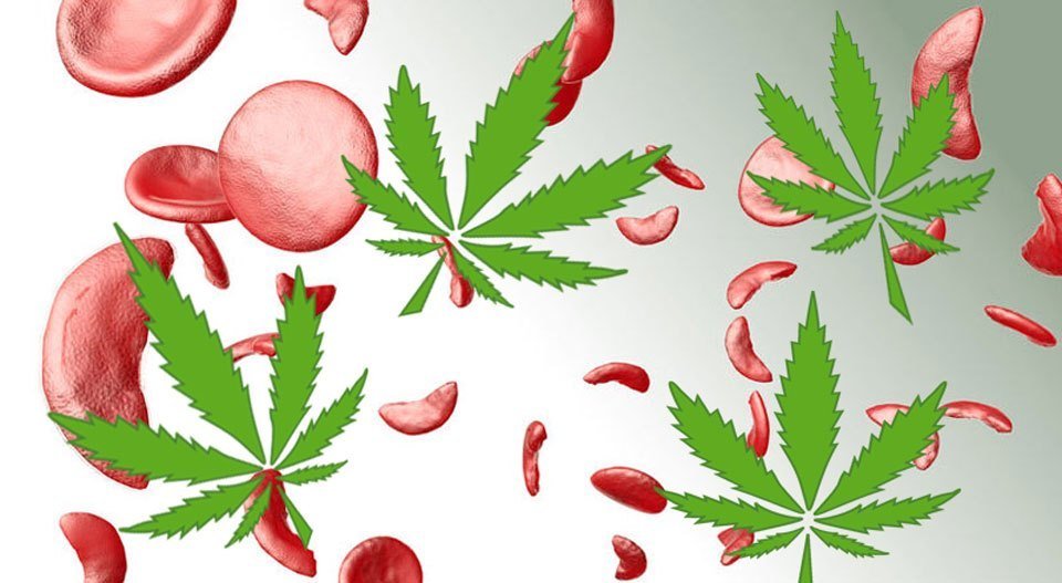 sickle cell disease and cannabis
