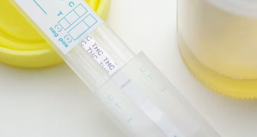 Ist CBD in einem Drogentest nachweisbar?