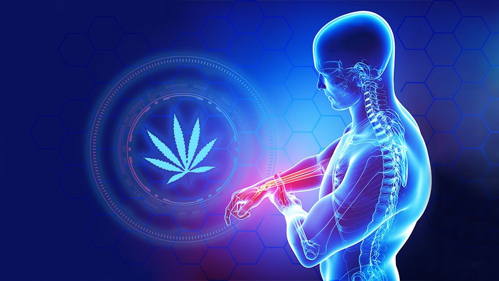 Cannabis und Arthritis