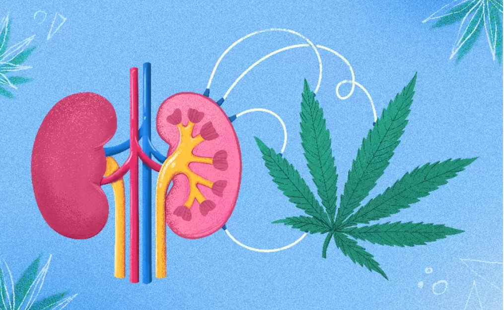 dialýza konopím - konopí zabraňuje mrtvici a onemocnění ledvin