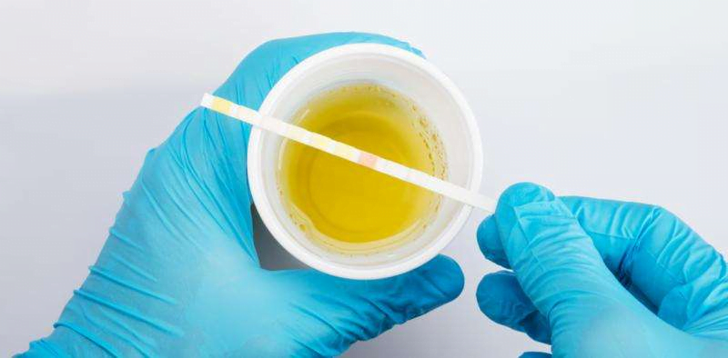 Test de dépistage du THC dans l'urine